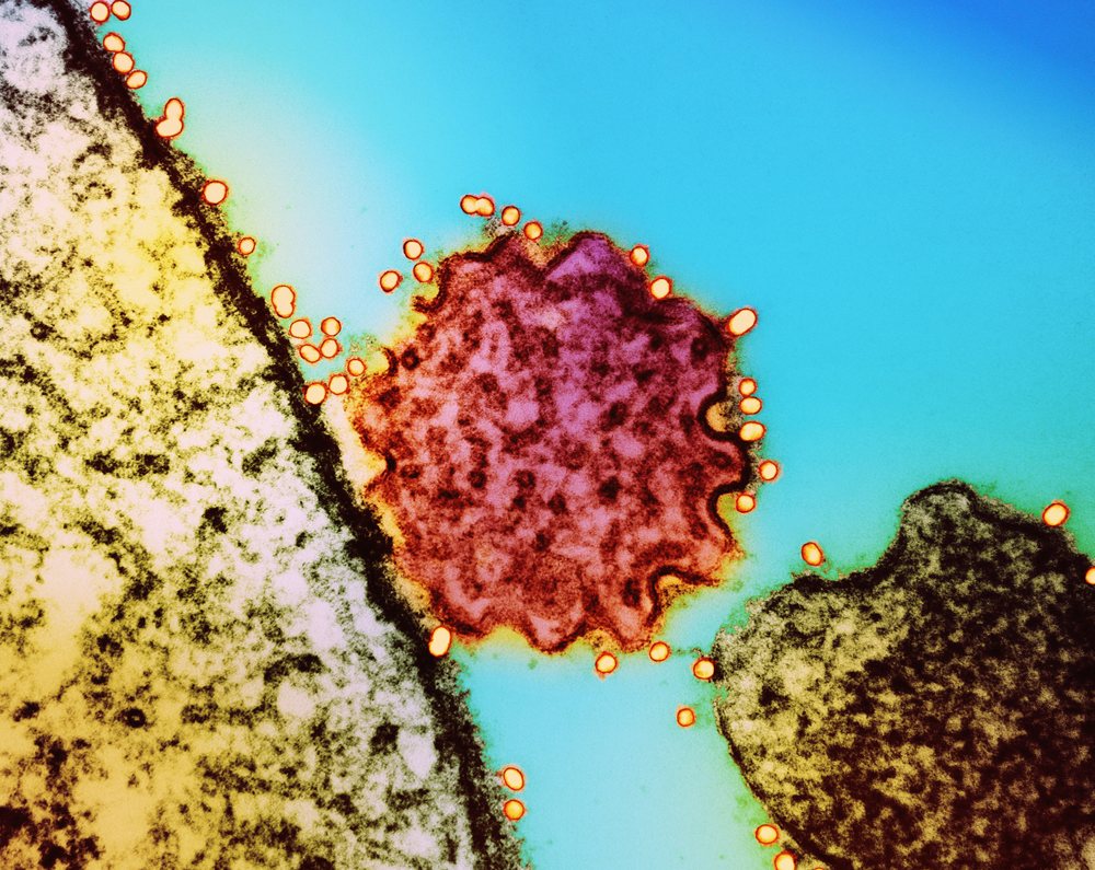 European Vaccine Initiative Backs First Human Trial of Nipah Virus Vaccine as India Confirms Cases
